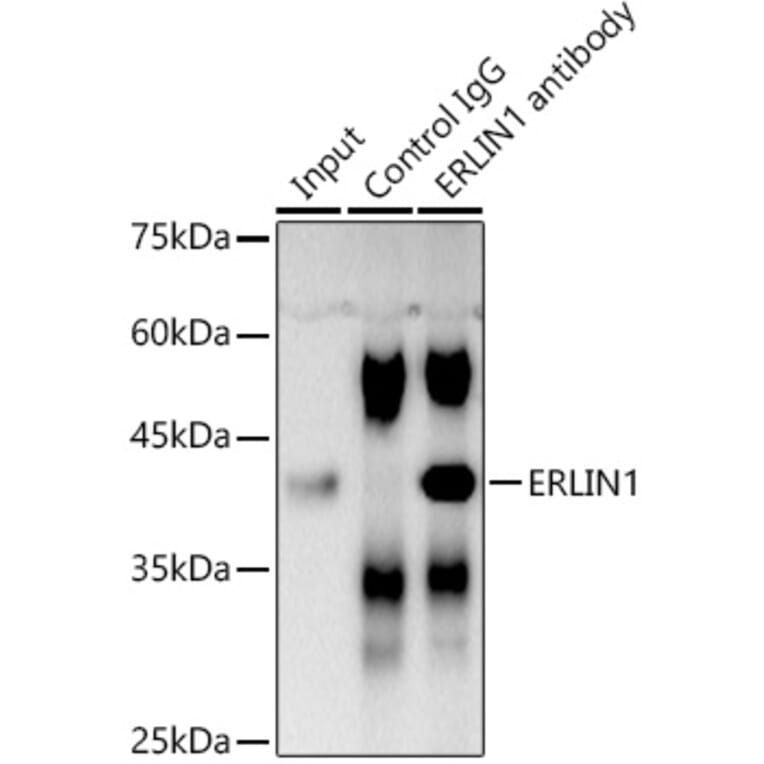 Western Blot - Anti-ERLIN1 Antibody (A89706) - Antibodies.com