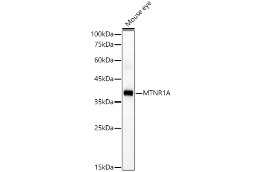 Western Blot - Anti-Melatonin Receptor 1A/MTNR1A Antibody (A89707) - Antibodies.com