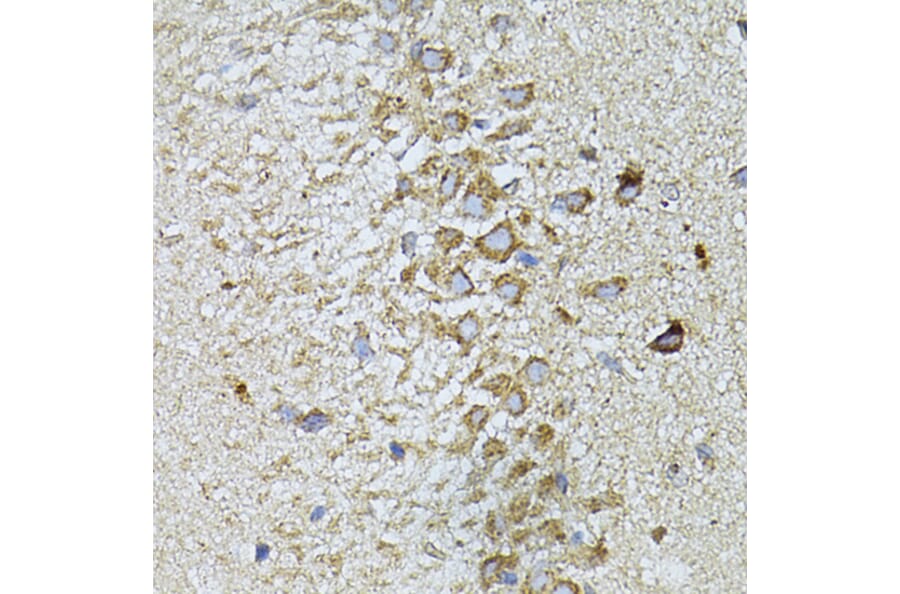 Immunohistochemistry - Anti-Melatonin Receptor 1A/MTNR1A Antibody (A89707) - Antibodies.com