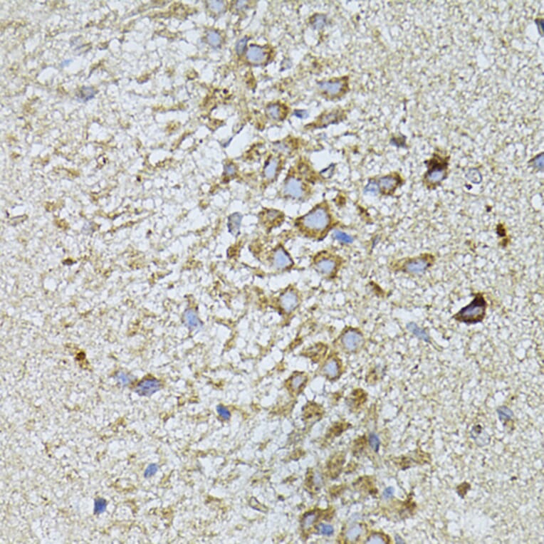 Immunohistochemistry - Anti-Melatonin Receptor 1A/MTNR1A Antibody (A89707) - Antibodies.com