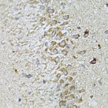 Immunohistochemistry - Anti-Melatonin Receptor 1A/MTNR1A Antibody (A89707) - Antibodies.com