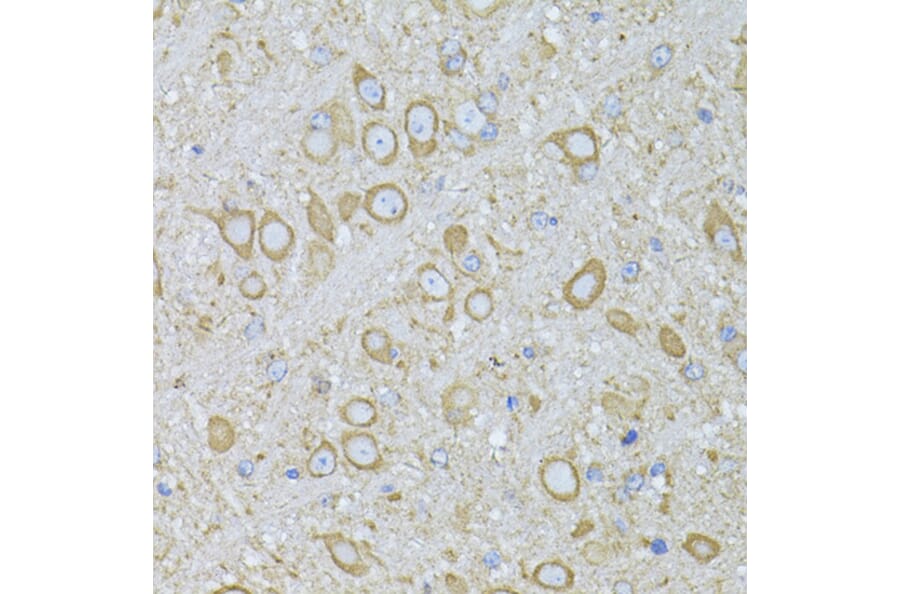 Immunohistochemistry - Anti-Melatonin Receptor 1A/MTNR1A Antibody (A89707) - Antibodies.com