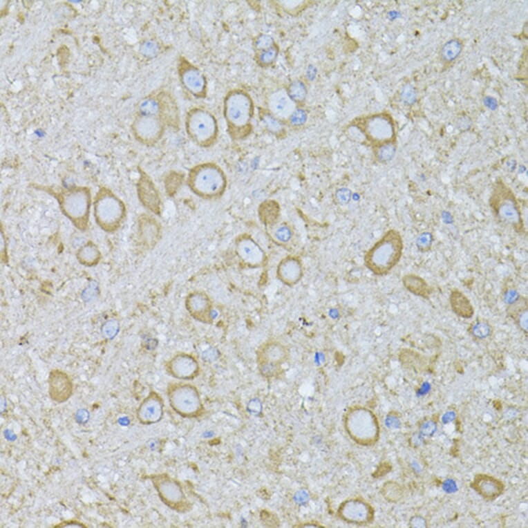 Immunohistochemistry - Anti-Melatonin Receptor 1A/MTNR1A Antibody (A89707) - Antibodies.com