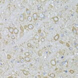 Immunohistochemistry - Anti-Melatonin Receptor 1A/MTNR1A Antibody (A89707) - Antibodies.com