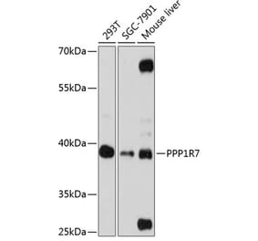 Western Blot - Anti-PPP1R7 Antibody (A89708) - Antibodies.com