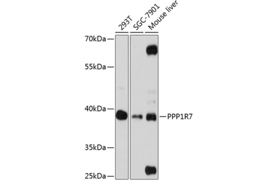 Western Blot - Anti-PPP1R7 Antibody (A89708) - Antibodies.com