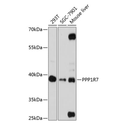 Western Blot - Anti-PPP1R7 Antibody (A89708) - Antibodies.com