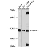 Western Blot - Anti-PPP1R7 Antibody (A89708) - Antibodies.com