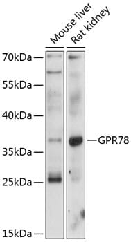 Western blot analysis of extracts of various cell lines, using Anti-GPR78 Antibody (A12364) at 1:1,000 dilution.
Secondary antibody: Goat Anti-Rabbit IgG (H+L) (HRP) (AS014) at 1:10,000 dilution.
Lysates / proteins: 25µg per lane.
Blocking buffer: 3% non-fat dry milk in TBST.
Detection: ECL Basic Kit (RM00020).
Exposure time: 30s.