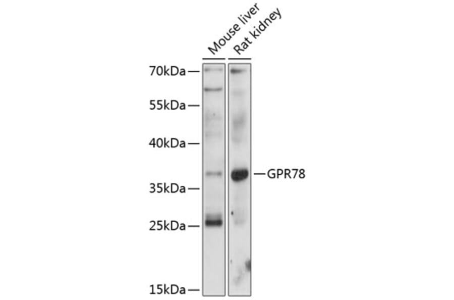Western Blot - Anti-GPCR GPR78 Antibody (A89709) - Antibodies.com