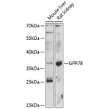 Western Blot - Anti-GPCR GPR78 Antibody (A89709) - Antibodies.com
