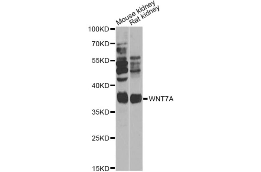 Western Blot - Anti-WNT7A Antibody (A14194) - Antibodies.com