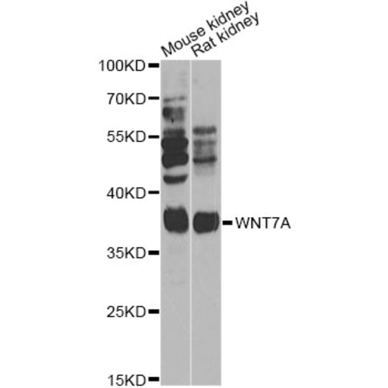 Western Blot - Anti-WNT7A Antibody (A14194) - Antibodies.com