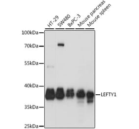 Western Blot - Anti-Lefty Antibody (A89711) - Antibodies.com