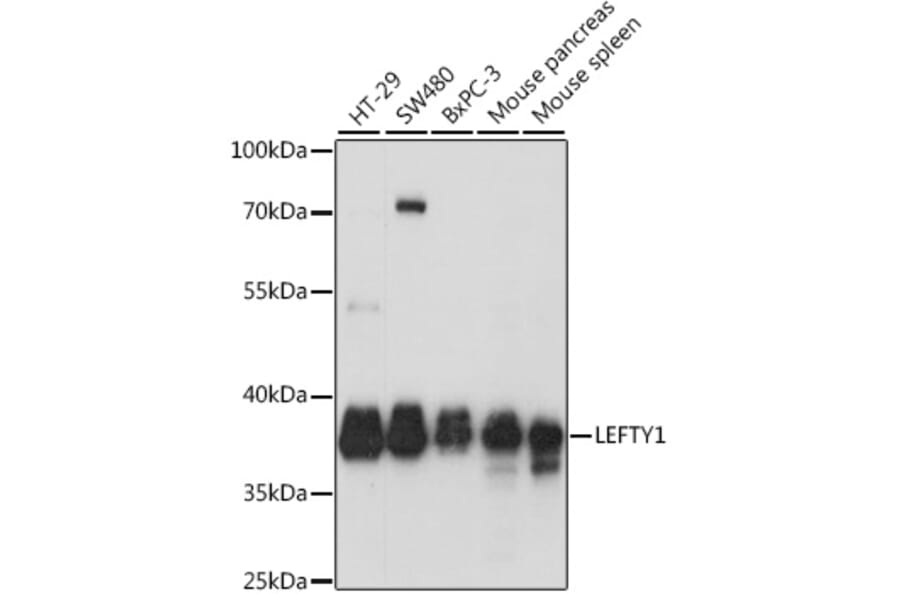 Western Blot - Anti-Lefty Antibody (A89711) - Antibodies.com