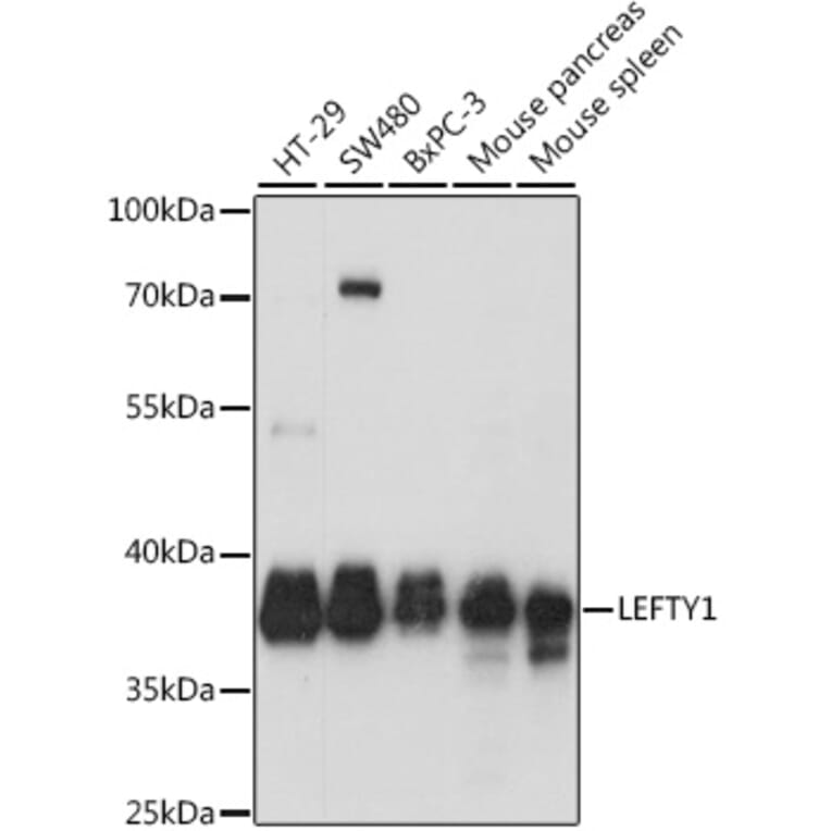 Western Blot - Anti-Lefty Antibody (A89711) - Antibodies.com