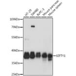 Western Blot - Anti-Lefty Antibody (A89711) - Antibodies.com