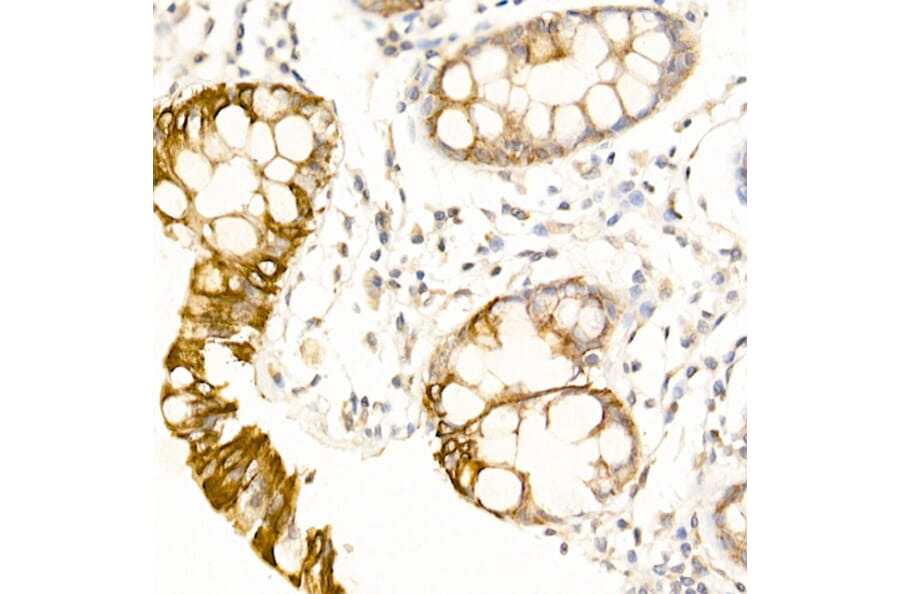 Immunohistochemistry - Anti-UBP43/USP18 Antibody (A89712) - Antibodies.com