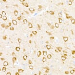 Immunohistochemistry - Anti-UBP43/USP18 Antibody (A89712) - Antibodies.com