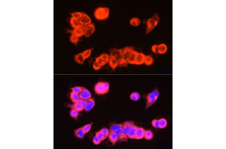 Immunofluorescence - Anti-UBP43/USP18 Antibody (A89712) - Antibodies.com