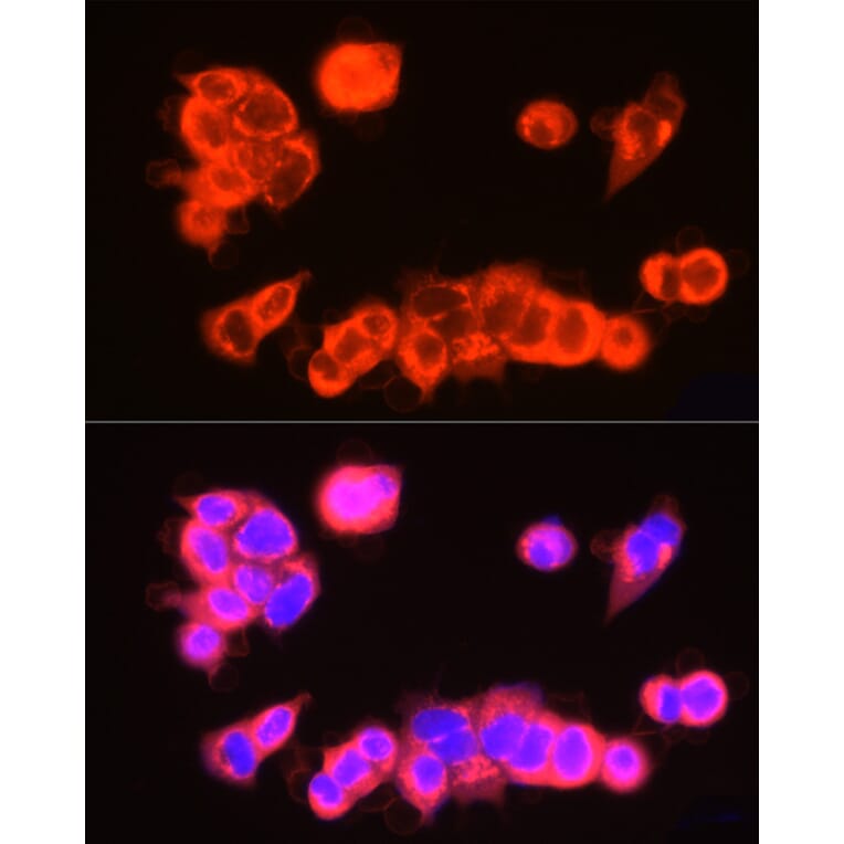 Immunofluorescence - Anti-UBP43/USP18 Antibody (A89712) - Antibodies.com