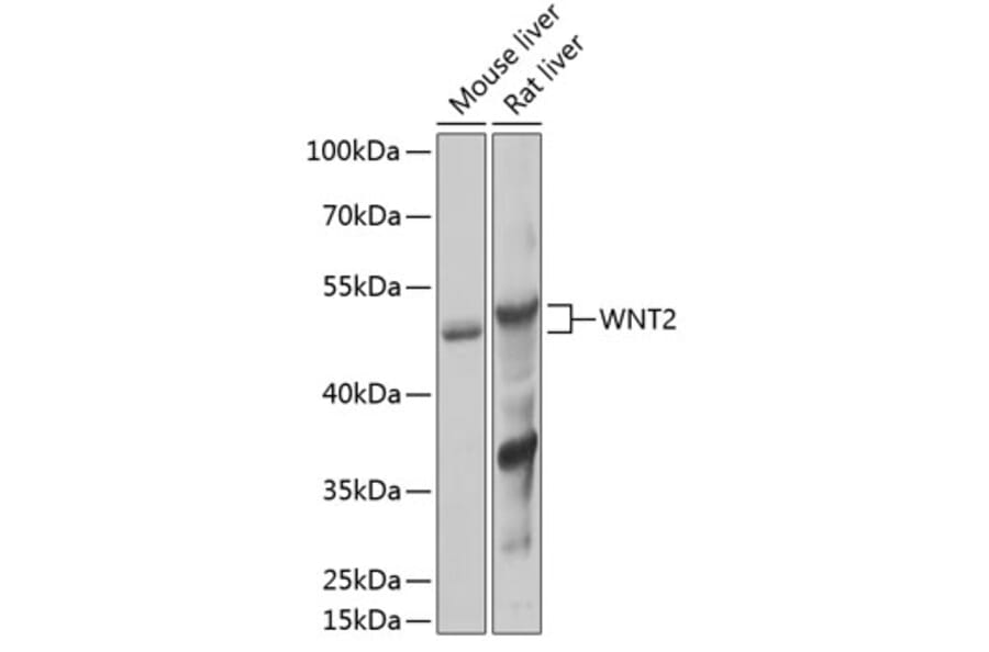 Western Blot - Anti-Wnt2/IRP Antibody (A89713) - Antibodies.com