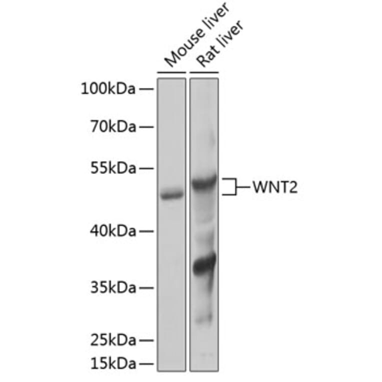 Western Blot - Anti-Wnt2/IRP Antibody (A89713) - Antibodies.com
