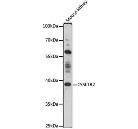 Western Blot - Anti-CysLT2 Antibody (A89714) - Antibodies.com