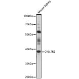 Western Blot - Anti-CysLT2 Antibody (A89714) - Antibodies.com