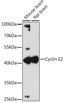 Western blot analysis of extracts of various cell lines, using Anti-CCNE2 Antibody (A4272) at 1:3000 dilution.
Secondary antibody: Goat Anti-Rabbit IgG (H+L) (HRP) (AS014) at 1:10,000 dilution.
Lysates / proteins: 25µg per lane.
Blocking buffer: 3% non-fat dry milk in TBST.
Detection: ECL Enhanced Kit (RM00021).
Exposure time: 90s.