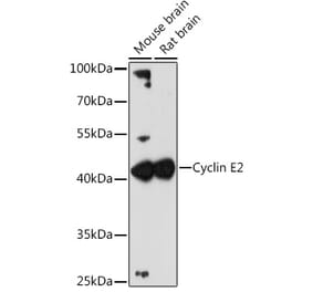 Western Blot - Anti-Cyclin E2 Antibody (A89715) - Antibodies.com