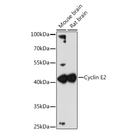 Western Blot - Anti-Cyclin E2 Antibody (A89715) - Antibodies.com