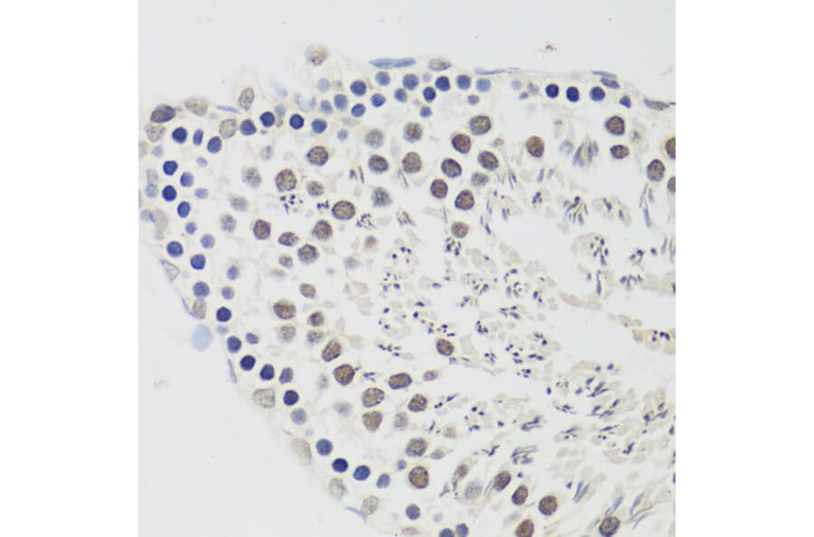 Immunohistochemistry - Anti-Cyclin E2 Antibody (A89715) - Antibodies.com