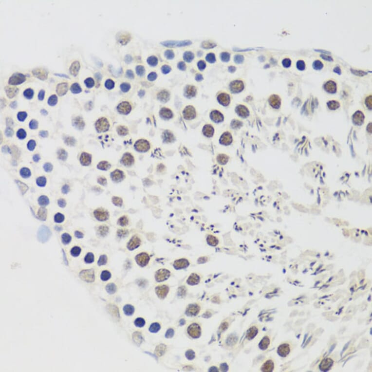 Immunohistochemistry - Anti-Cyclin E2 Antibody (A89715) - Antibodies.com