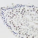 Immunohistochemistry - Anti-Cyclin E2 Antibody (A89715) - Antibodies.com