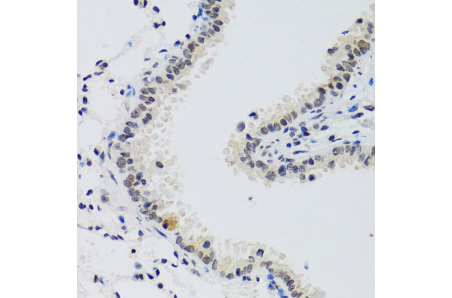 Immunohistochemistry - Anti-Cyclin E2 Antibody (A89715) - Antibodies.com