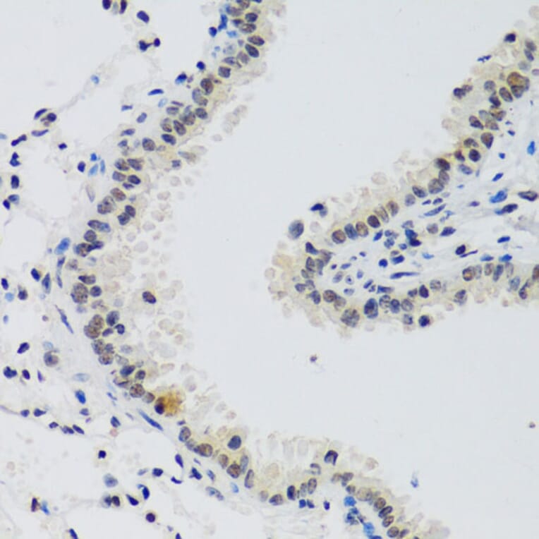 Immunohistochemistry - Anti-Cyclin E2 Antibody (A89715) - Antibodies.com