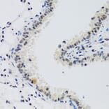 Immunohistochemistry - Anti-Cyclin E2 Antibody (A89715) - Antibodies.com