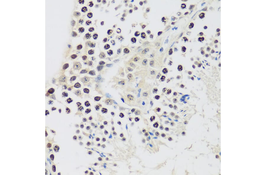 Immunohistochemistry - Anti-Cyclin E2 Antibody (A89715) - Antibodies.com