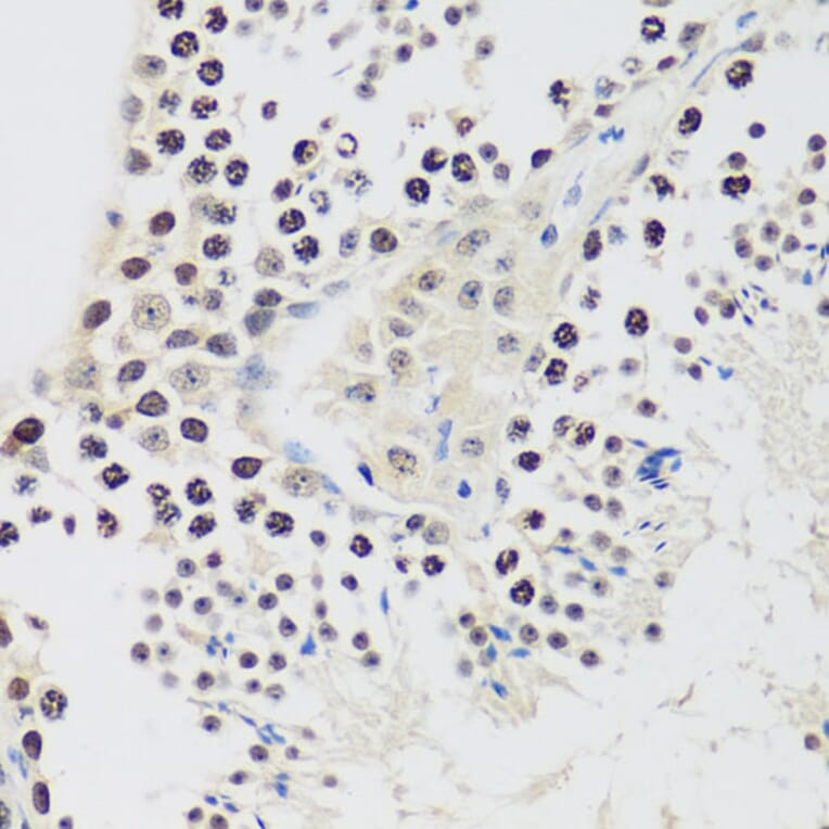 Immunohistochemistry - Anti-Cyclin E2 Antibody (A89715) - Antibodies.com