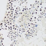 Immunohistochemistry - Anti-Cyclin E2 Antibody (A89715) - Antibodies.com