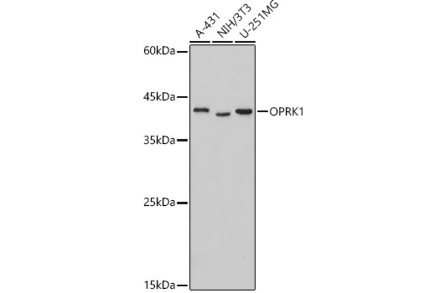 Western Blot - Anti-Kappa Opioid Receptor Antibody (A89716) - Antibodies.com