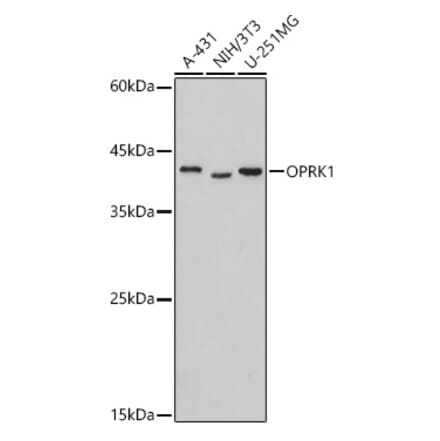 Western Blot - Anti-Kappa Opioid Receptor Antibody (A89716) - Antibodies.com