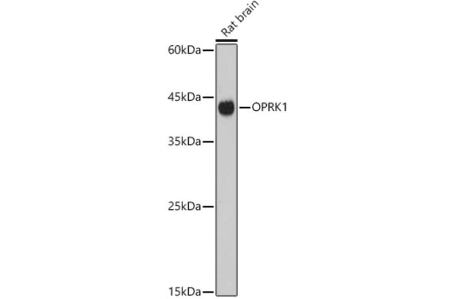 Western Blot - Anti-Kappa Opioid Receptor Antibody (A89716) - Antibodies.com