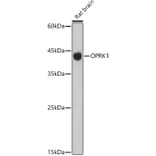 Western Blot - Anti-Kappa Opioid Receptor Antibody (A89716) - Antibodies.com