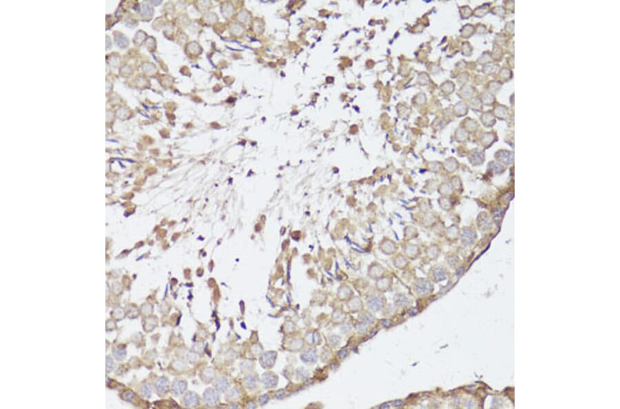 Immunohistochemistry - Anti-Kappa Opioid Receptor Antibody (A89716) - Antibodies.com