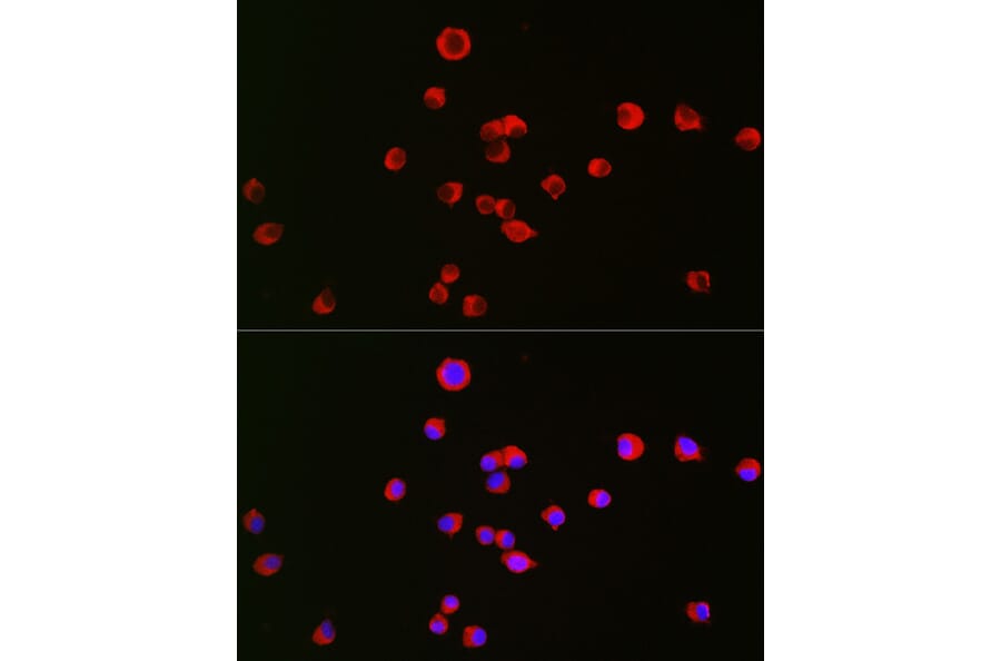 Immunofluorescence - Anti-Kappa Opioid Receptor Antibody (A89716) - Antibodies.com
