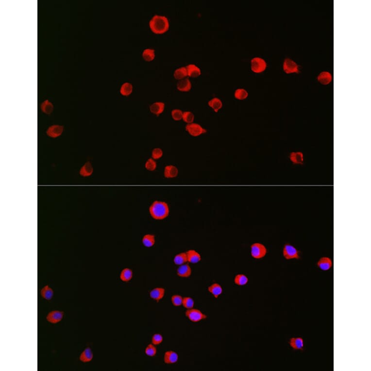 Immunofluorescence - Anti-Kappa Opioid Receptor Antibody (A89716) - Antibodies.com