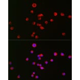 Immunofluorescence - Anti-Kappa Opioid Receptor Antibody (A89716) - Antibodies.com