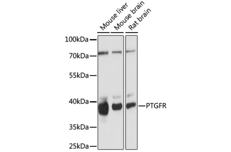 Western Blot - Anti-Prostaglandin F2 alpha Receptor/PTGFR Antibody (A89717) - Antibodies.com
